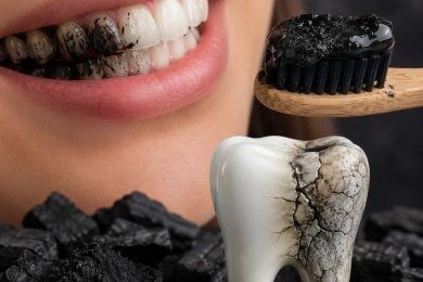 O Perigo do Carvão Ativado: Por Que a Promessa do “Sorriso Branco” Pode Destruir Seu Esmalte