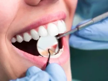 Limpeza dentária/Profilaxia