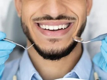 Clareamento Dental