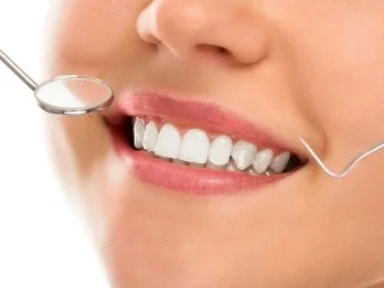 Restauração Dental